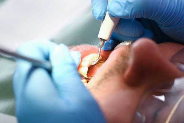 24-Hour Dental Clinic Near Me in LA
