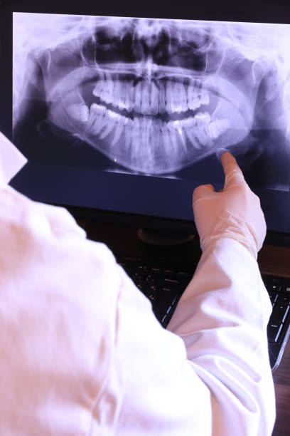Best Chipped Tooth Repair Near Me  in Lockport, LA