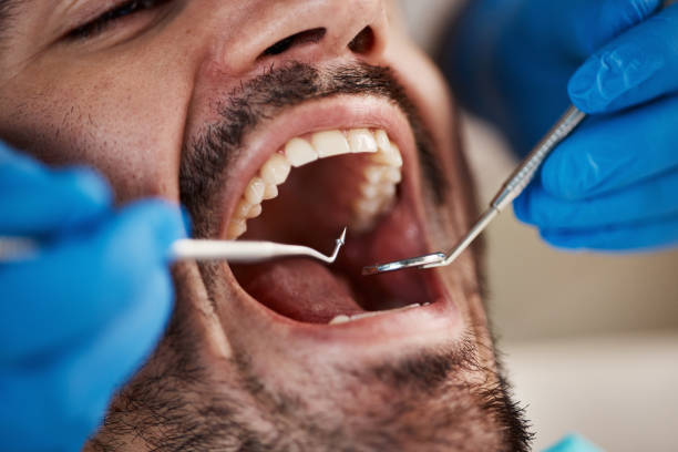 Best Urgent Tooth Repair  in Lockport, LA